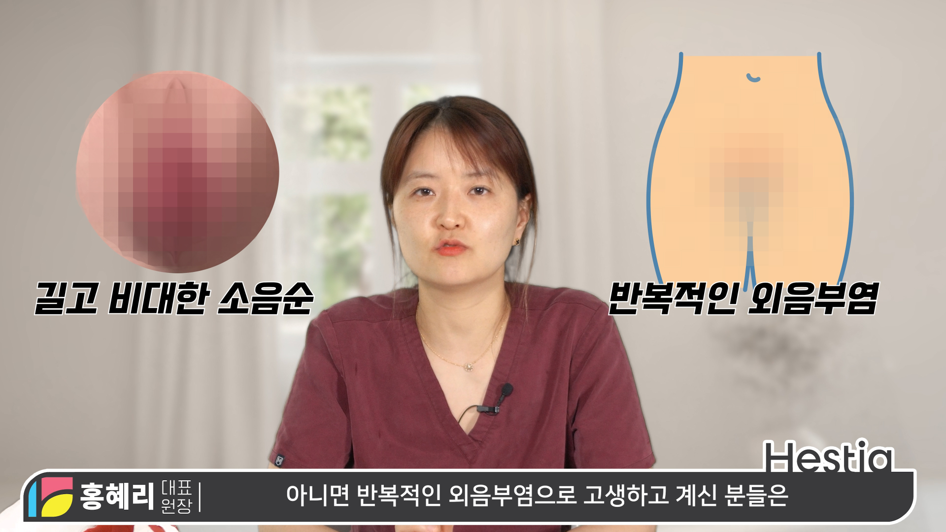소음순성형수술 과정 대.공.개 ※수술 시물레이션 포함!