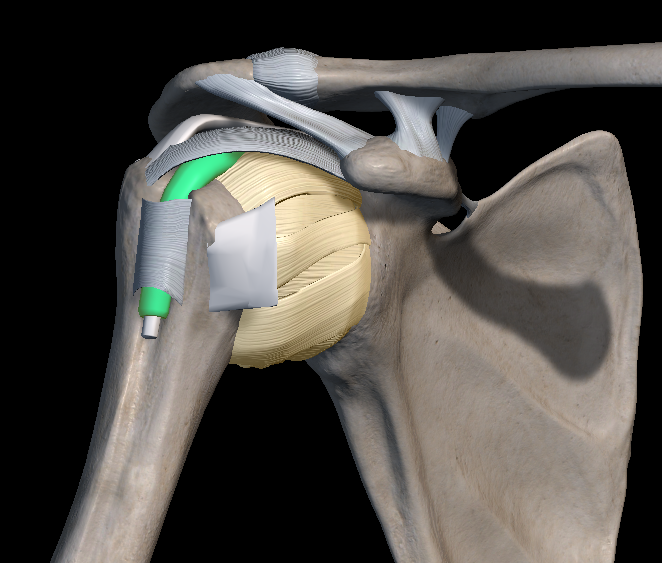 오십견 증상 원인 치료방법