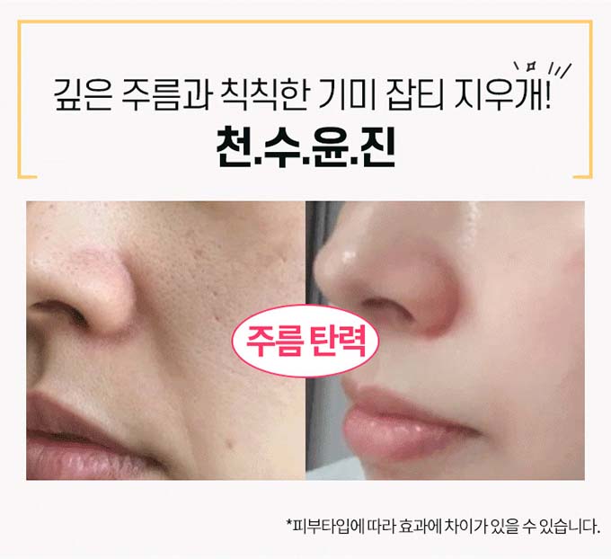 천수윤진 크림 효과