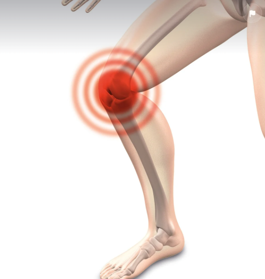 관절 통증의 원인