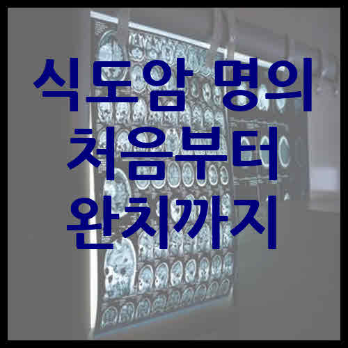 식도암 명의 처음부터 완치까지 진료할 수 있는 병원