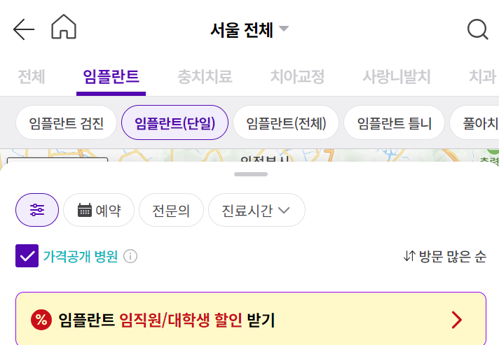 임플란트 가격비교 검색 방법
