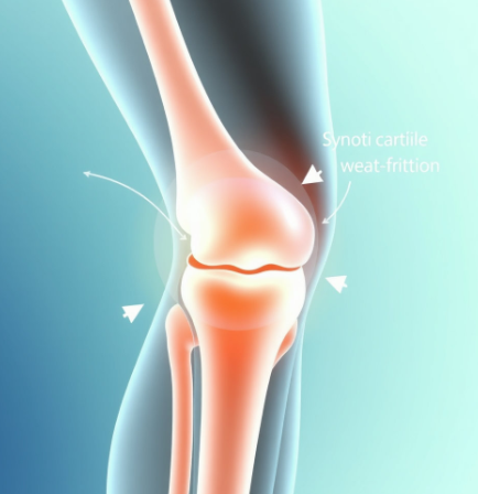 관절오만보-가격-성분-소연골-콘드로이친-효능