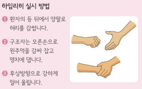 어린이 하임리히법