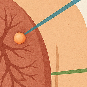 폐결절부터 성대결절·림프절 결절 총정리