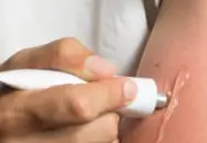 땀띠 원인과 증상 &amp; 치료