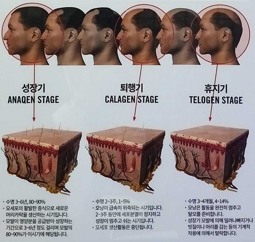 모발 성장 주기