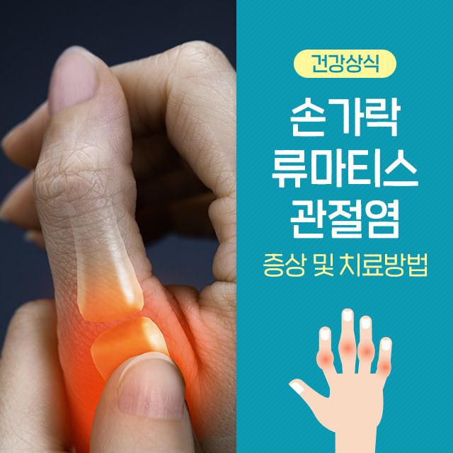 류마티스 관절염