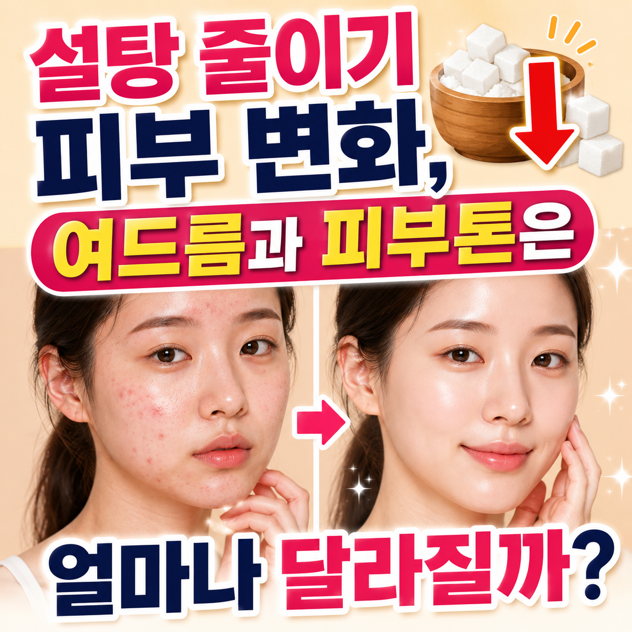 설탕 줄이기 피부 변화