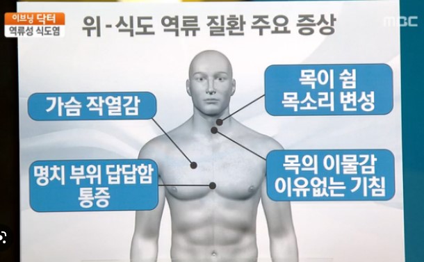 역류성 식도염