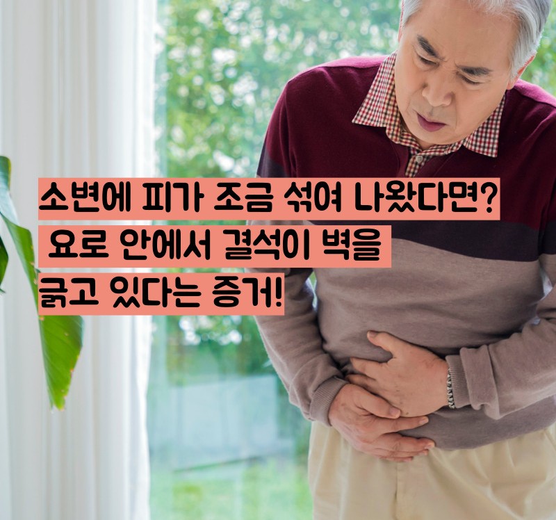 요로결석 증상