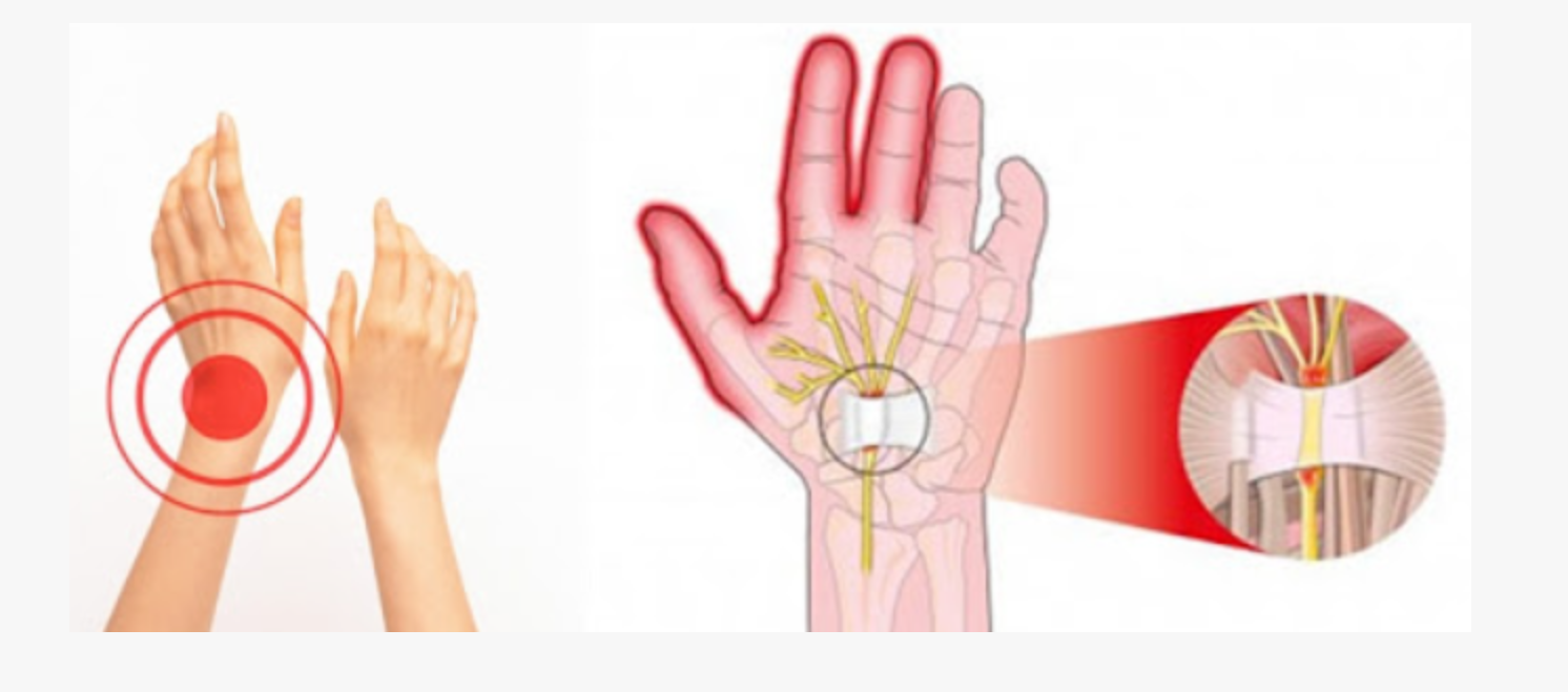 손가락 마디 통증이란?