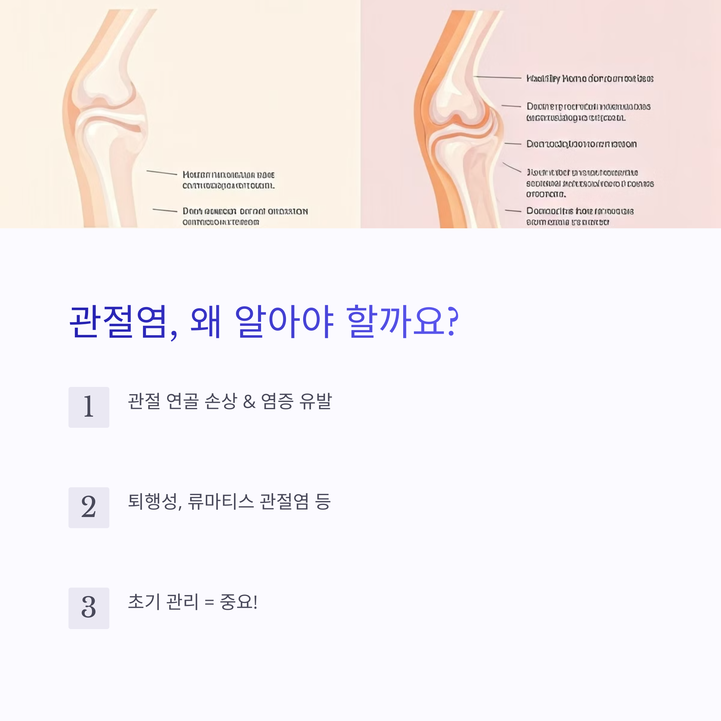 관절염 초기 자가진단