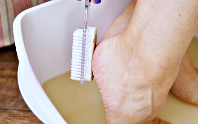 발뒤꿈치 각질제거 갈라짐,뒤꿈치 굳은살 제거,레몬껍질,풋크림