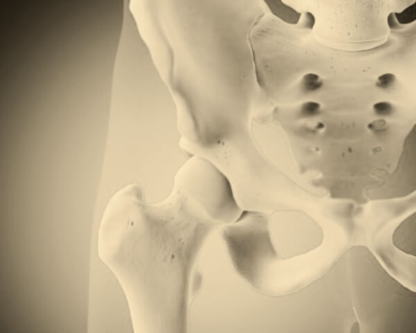 고관절-근접-사진