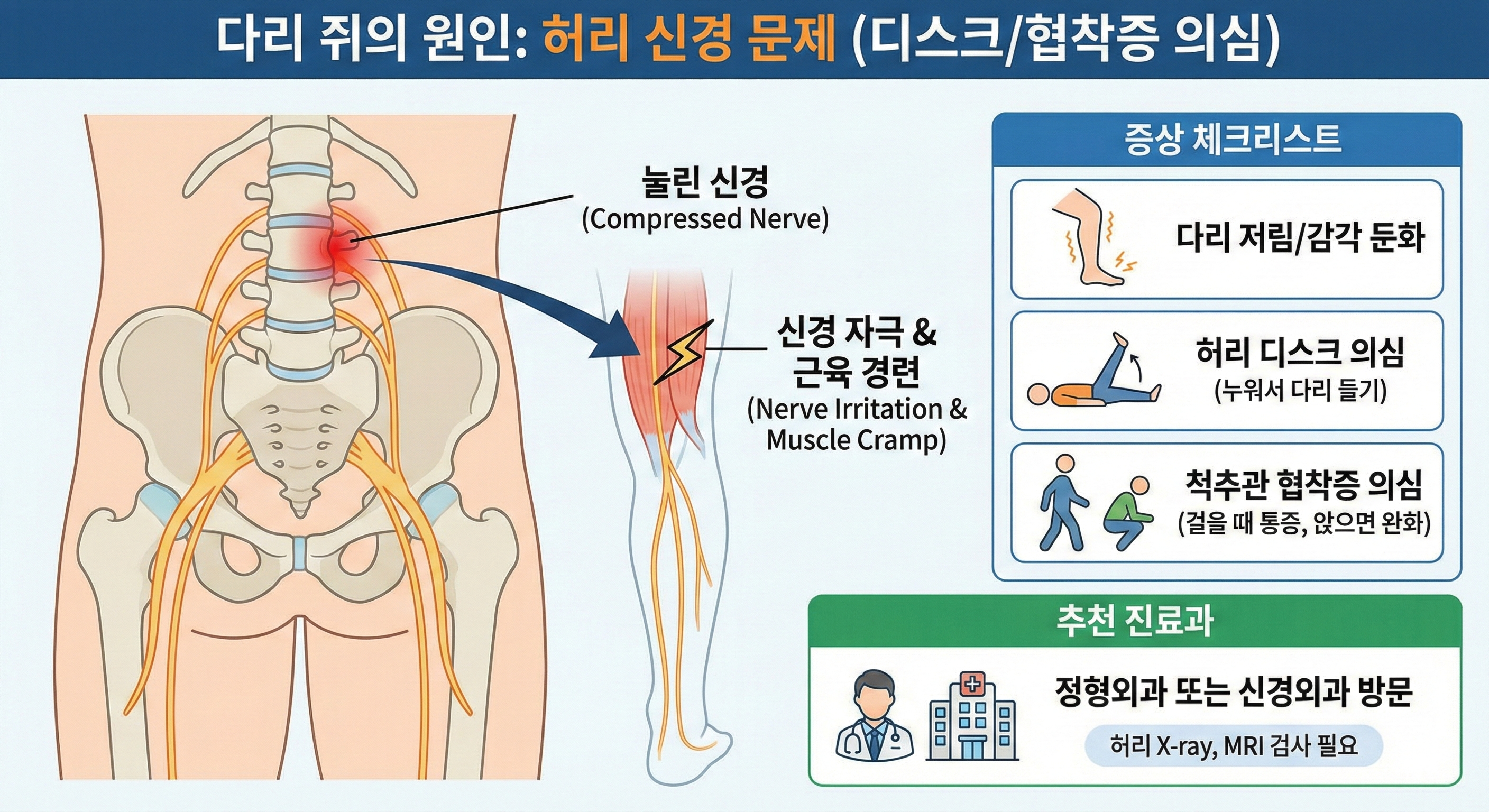 다리 쥐 원인: 허리 신경 문제