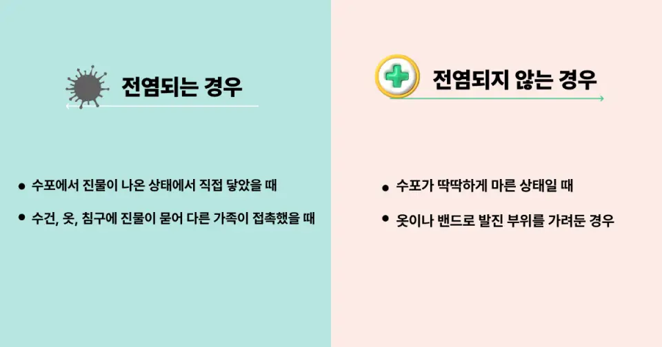 대상포진 전염되는 경우와 전염 안되는 경우 비교 설명 이미지