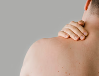 피부가려움증의 원인 13