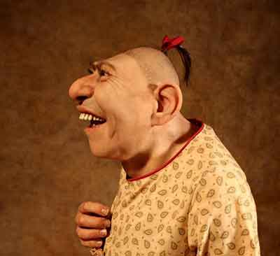 위로 젖혀진 이마