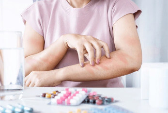 알룰로스(Allulose)