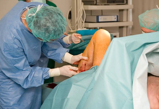 하지정맥류 발거술 치료법