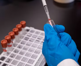 폐경기 생리증상 변화 대처법