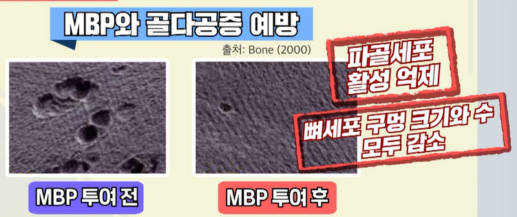 MBP 효능