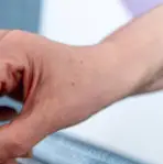 백내장 초기증상 백내장이란 무엇인가 &mdash; 눈 속 렌즈가 흐려지는 순간