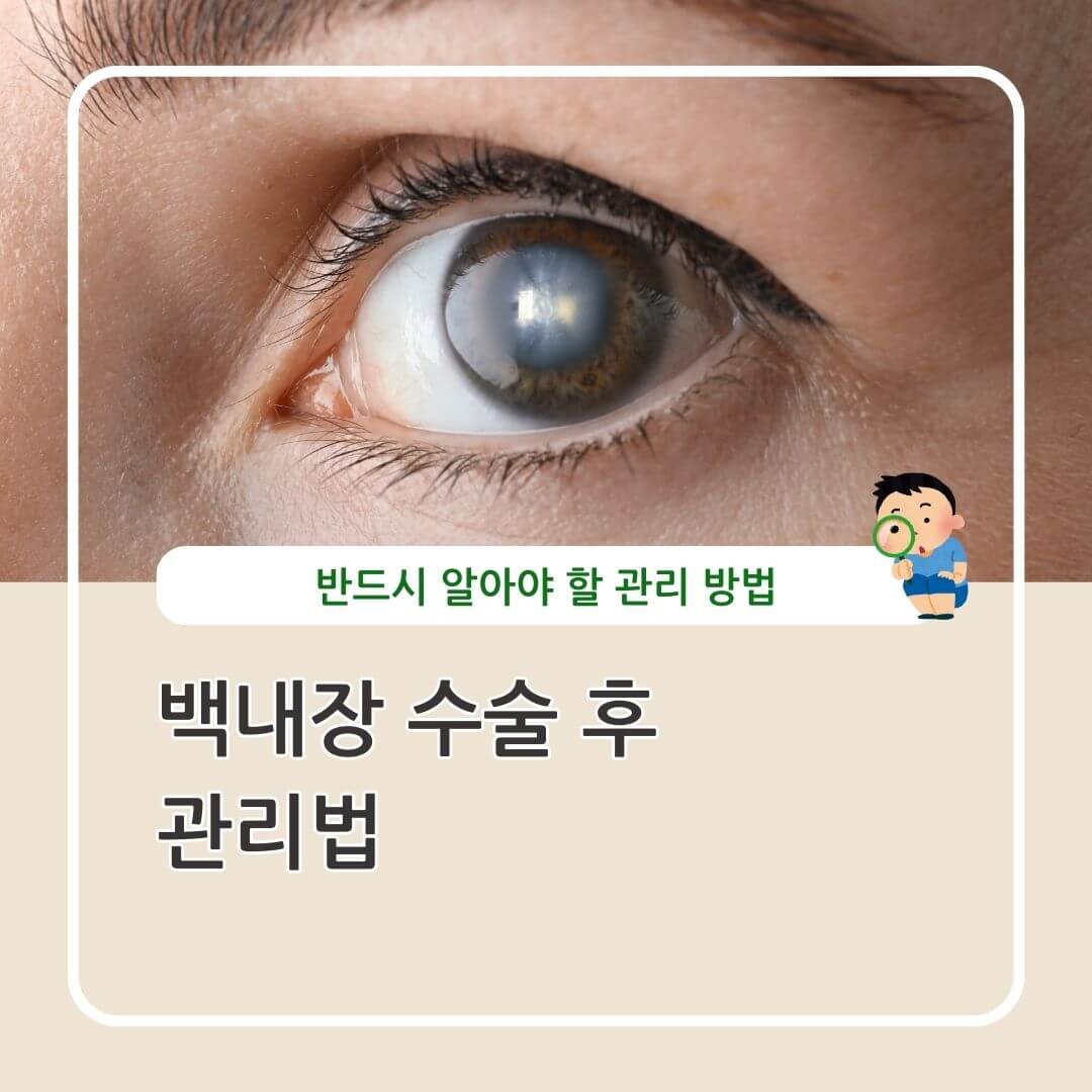 백내장 수술 후 관리법