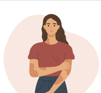 대상포진 예방접종 가격(최저가) 초기증상 치료방법 총정리