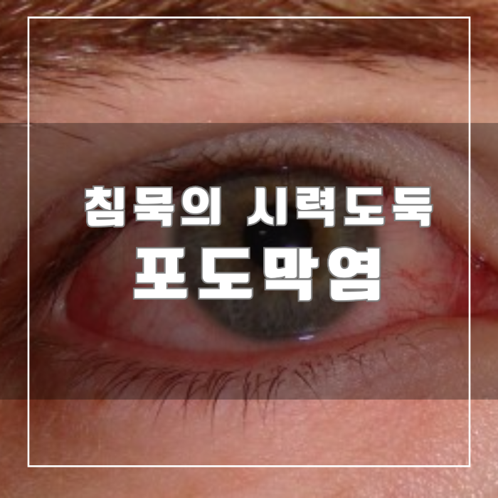 포도막염