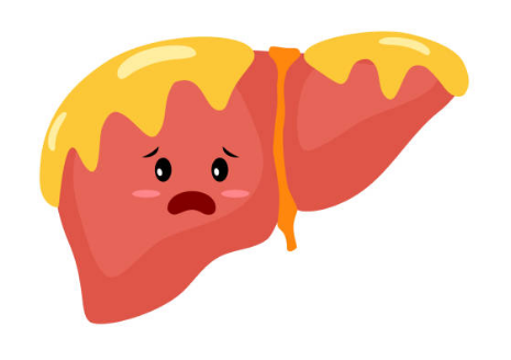 지방간 증상, 없애는 방법, 원인 총정리 (2024ver)