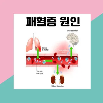 패혈증이란 무엇인지 원인 증상 치료 예방법_2