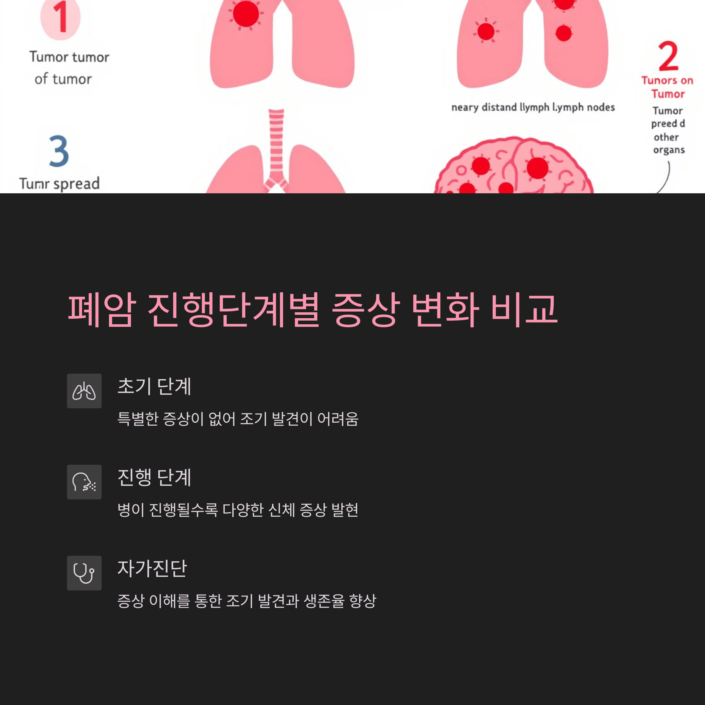 폐암 진행단계별 증상 변화 비교