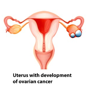 카나리아바이오 하한가 루머 및 기업정보 차트 전망