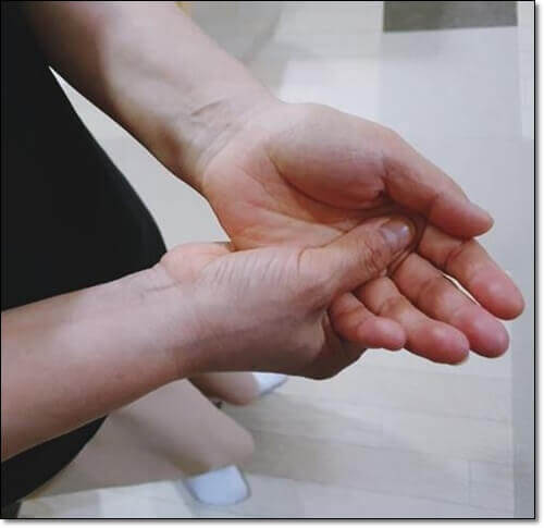 수전증