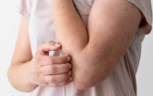 아르기닌 효능 부작용