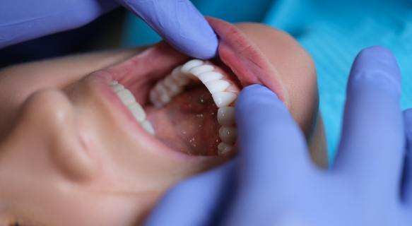 턱이 아플때 어디로 가야 해? 구강내과 vs 구강외과 차이