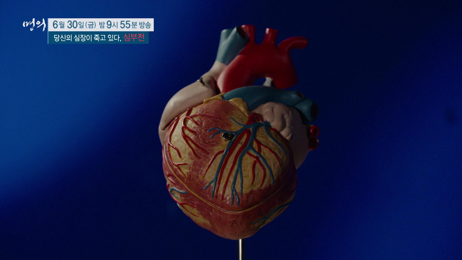당신의 심장이 죽고 있다, 심부전 원인, 진단기준, 증상, 치료 방법 삼성서울병원 순환기내과 최진오 교수 예약 추천