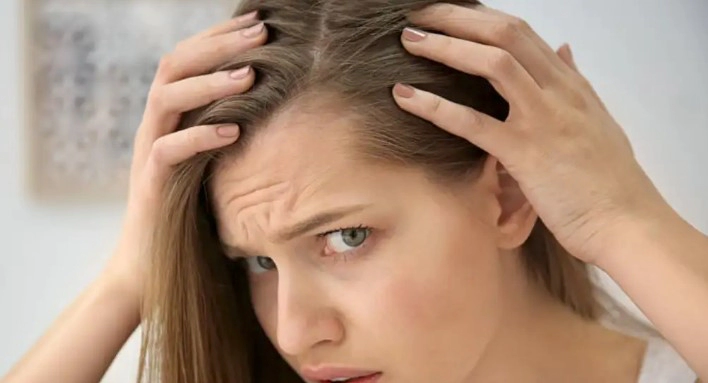 탈모 유전 확률 및 모계유전