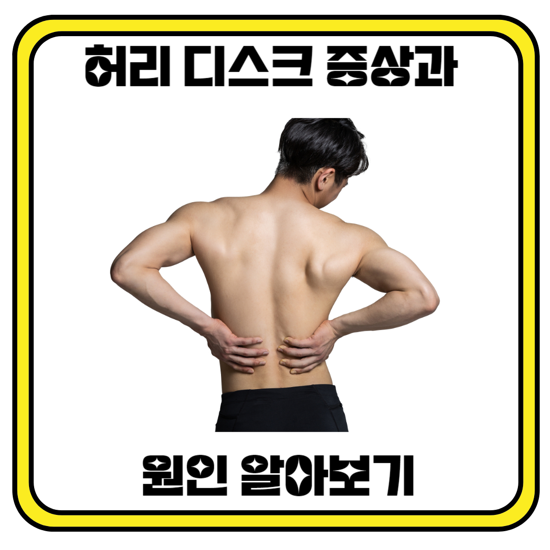 허리 디스크 증상과 원인