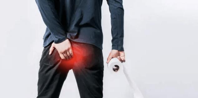 치질의 증상과 치질 자가치료법, 치질 예방법 요약정리