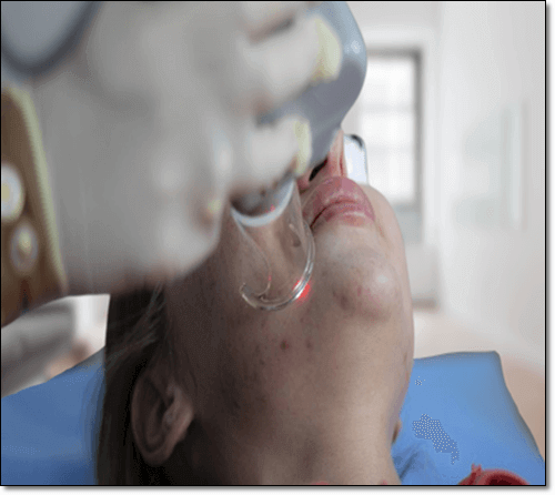 표피낭종 시술 및 수술