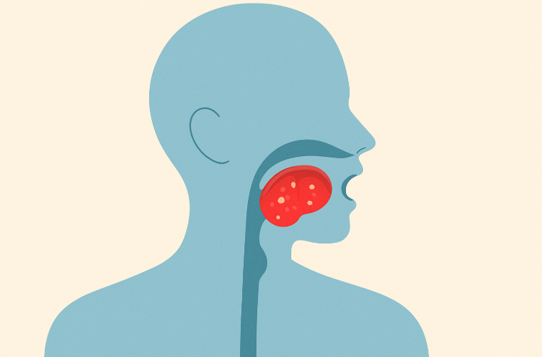 편도선이 붓는 이유