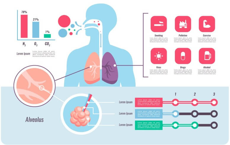 갑상선 기능 항진증에 대해 설명하는 그림