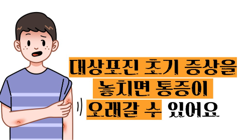 대상포진 초기증상