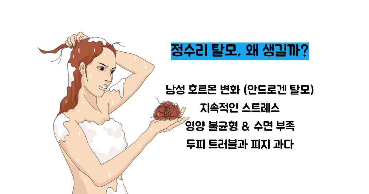 정수리 탈모