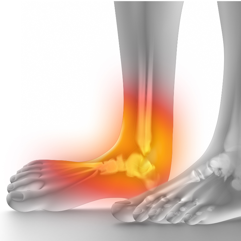 발목 안쪽 통증 원인 치료법