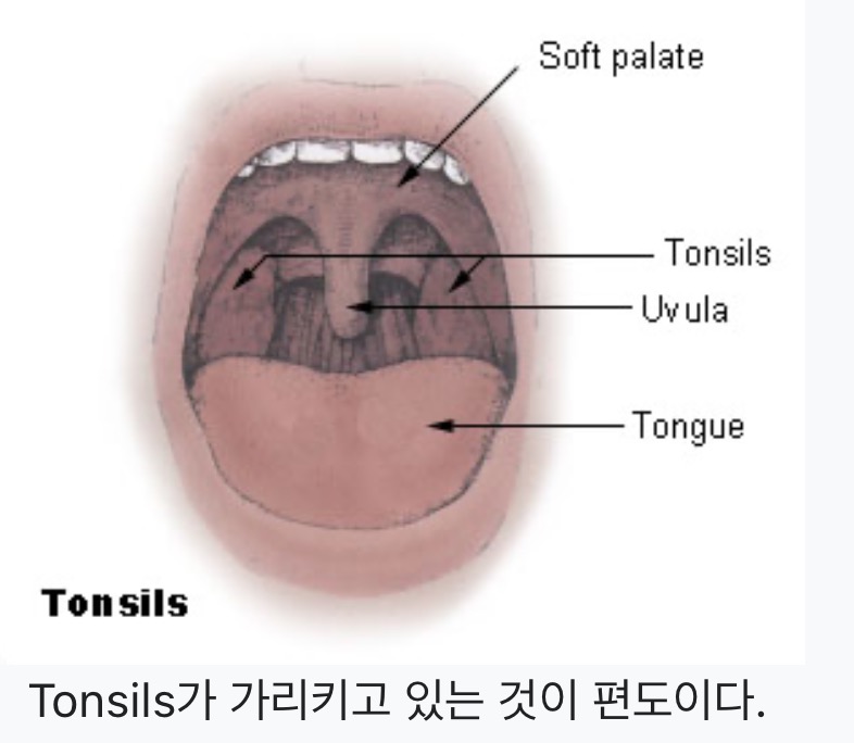 편도선 사진