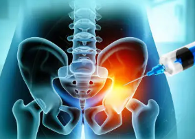 고관절 통증 증상 11